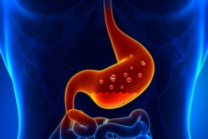 gastritis