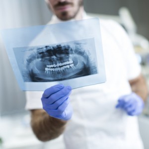 Dentist analyzing x-ray of teeth