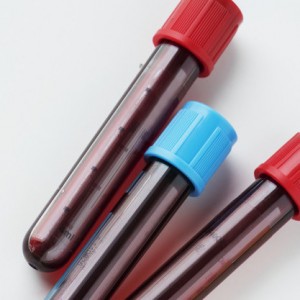 Closeup of blood tube test