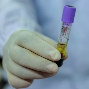 hipertrofobia2